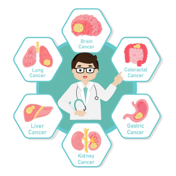 cancer,cancer insurance,hospitalization,radiation,surgery,cancer specific policy,protection from cancer,expert advice,hassel policy,speedy claim,how does cancer insurance work,maturity,types of cancer insurance work,brain cancer,coloctrol cancer,gastric cancer,kidney cancer,liver canacer,lung cancer,multiple cancer stages,lumpsum payment,tax benefit,contium coverage,following cancer,how does cancer insurance differ from cancer insuranc eplan,why should you buy cancer insurance plan